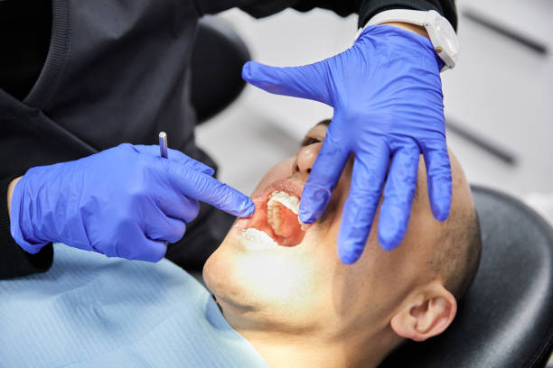 Best Emergency Dental Care for Broken or Chipped Teeth in Muskogee, OK